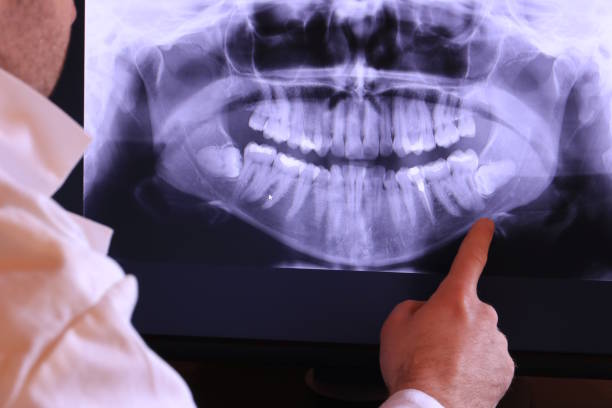 Best Knocked-Out Tooth Emergency  in Mickleton, NJ